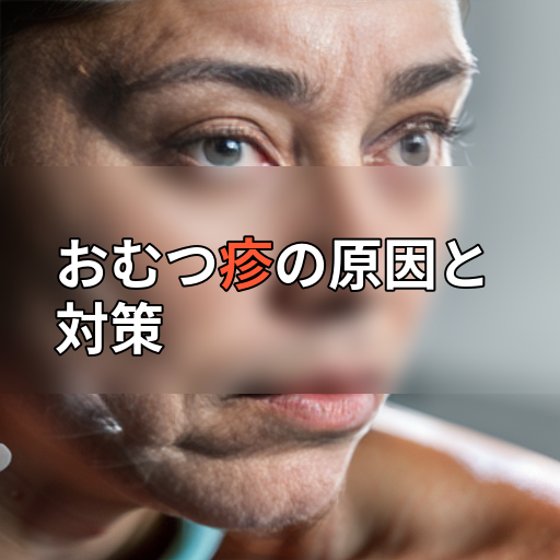 おむつ疹の原因と対策の画像